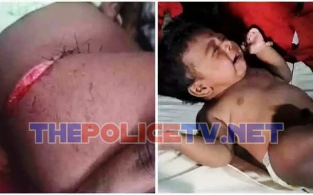 பச்சிளம் குழந்தையை கடித்து குதறிய குரங்கு; அப்புறப்படுத்த கோரி பொது மக்கள் கோரிக்கை